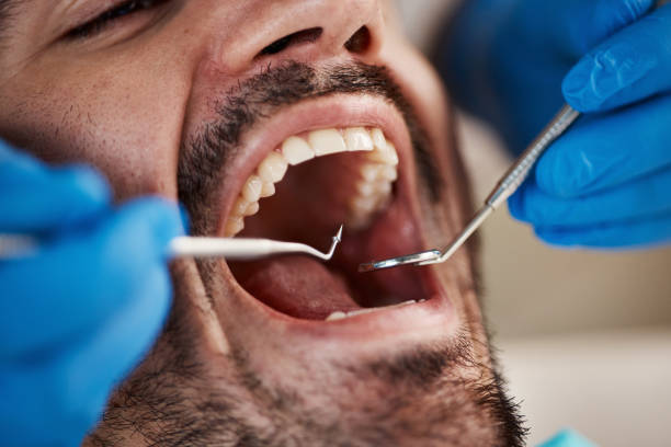 Best Sedation Dentistry  in Vernon, TX